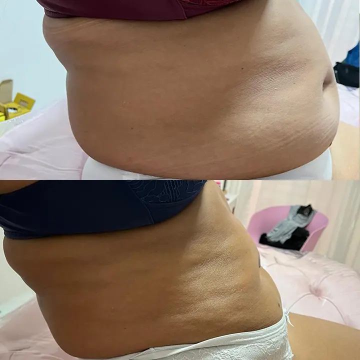 AnyConv.com__Paciente-1-B