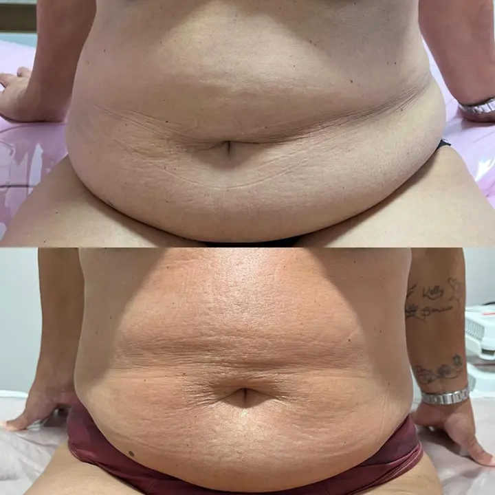 AnyConv.com__Paciente-2-A