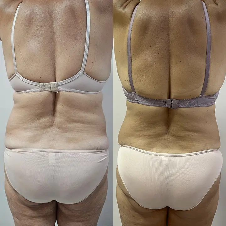 AnyConv.com__Paciente-3-A