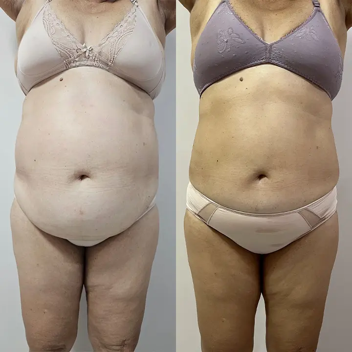 AnyConv.com__Paciente-3-B