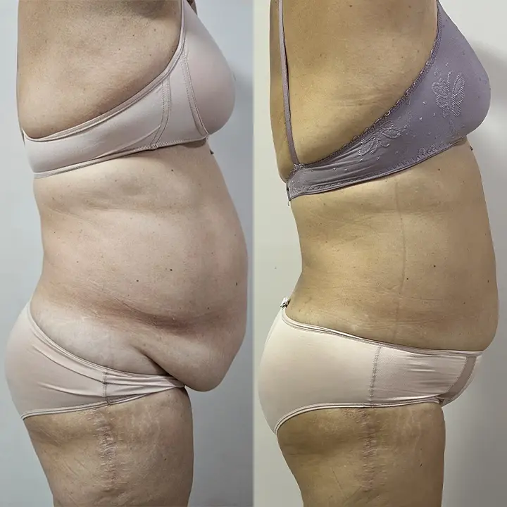 AnyConv.com__Paciente-3-C