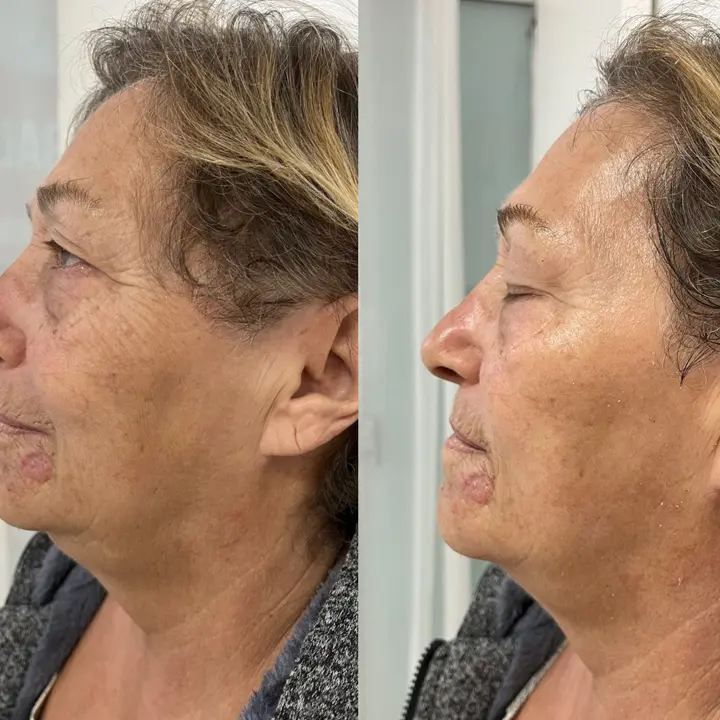 AnyConv.com__coreano-1