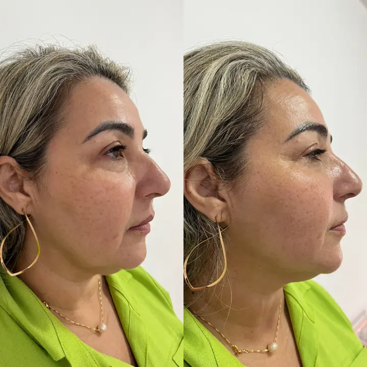 AnyConv.com__coreano-2