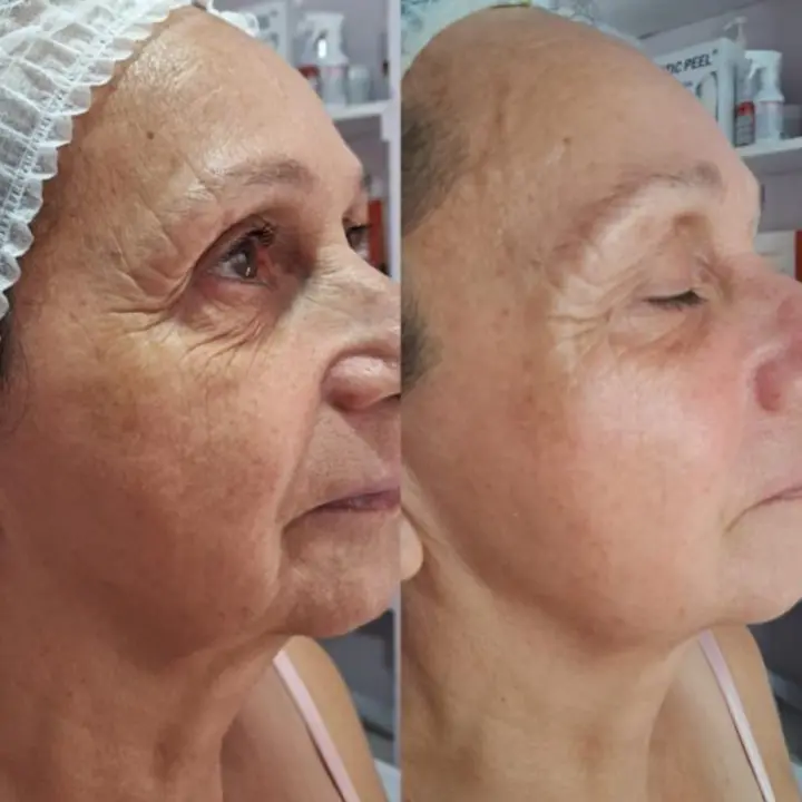 AnyConv.com__coreano-3