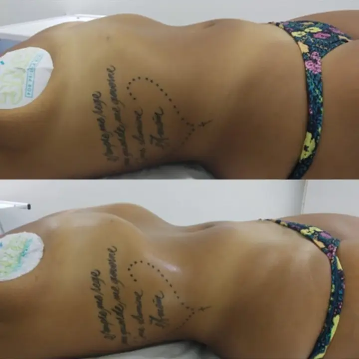 AnyConv.com__detox-2