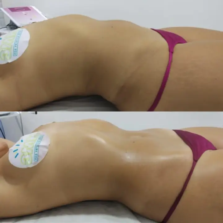 AnyConv.com__detox-3