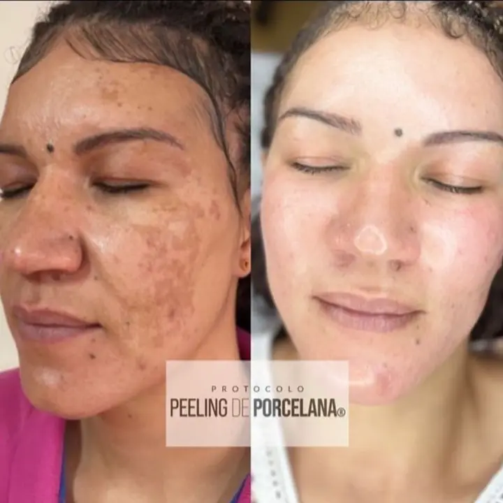 AnyConv.com__porcelana-1