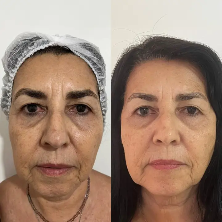 AnyConv.com__ultrassom-1