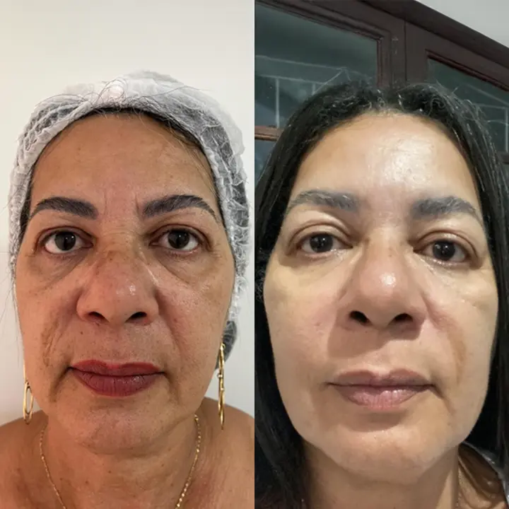 AnyConv.com__ultrassom-2